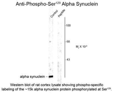 Western Blot: alpha-Synuclein [p Ser129] Antibody [NB300-746]